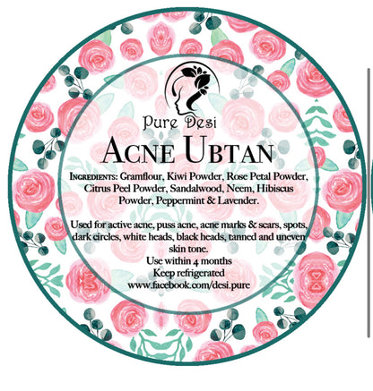 Acne Ubtan